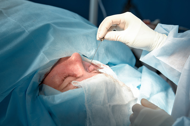 Conditions We Treat with Oculoplastic Surgery